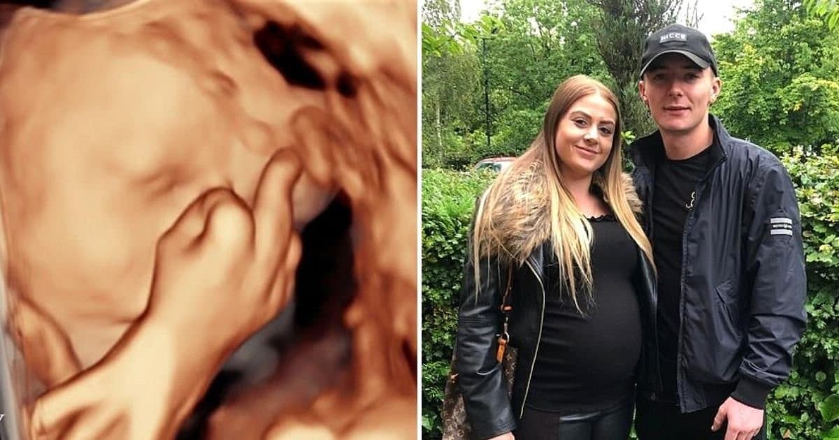 Nenarodené bábätko pobavilo rodičov! Počas 4D ultrazvuku im ukázalo prostredný prst