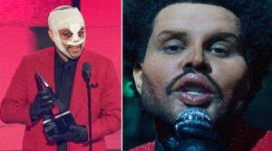 The Weeknd odhalil nový klip aj novú tvár. Fanúšikovia sú v šoku, naozaj podstúpil plastickú operáciu?